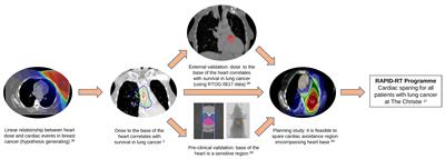 Role of Real-World Data in Assessing Cardiac Toxicity After Lung Cancer Radiotherapy